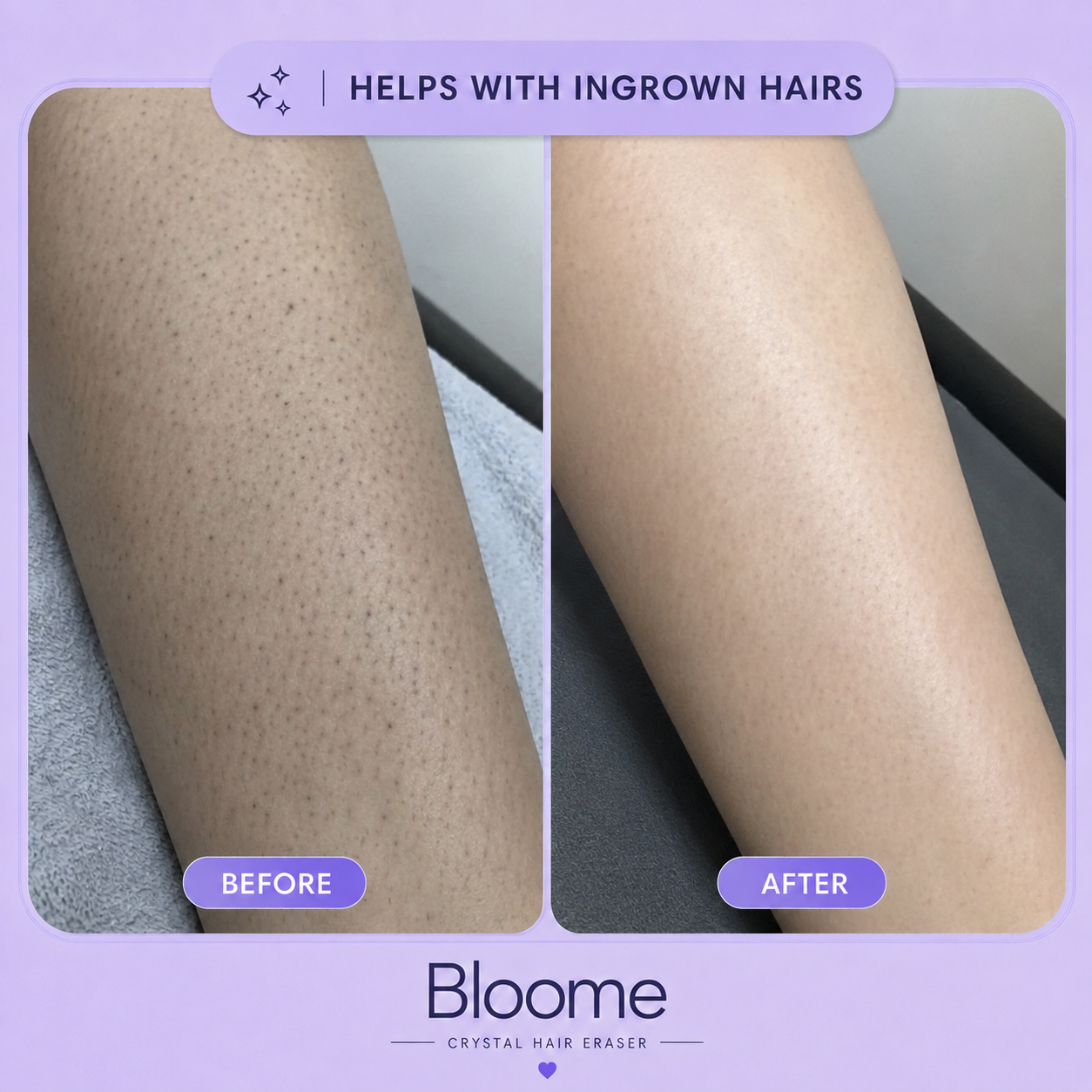 Bloome Crystal Hair Eraser