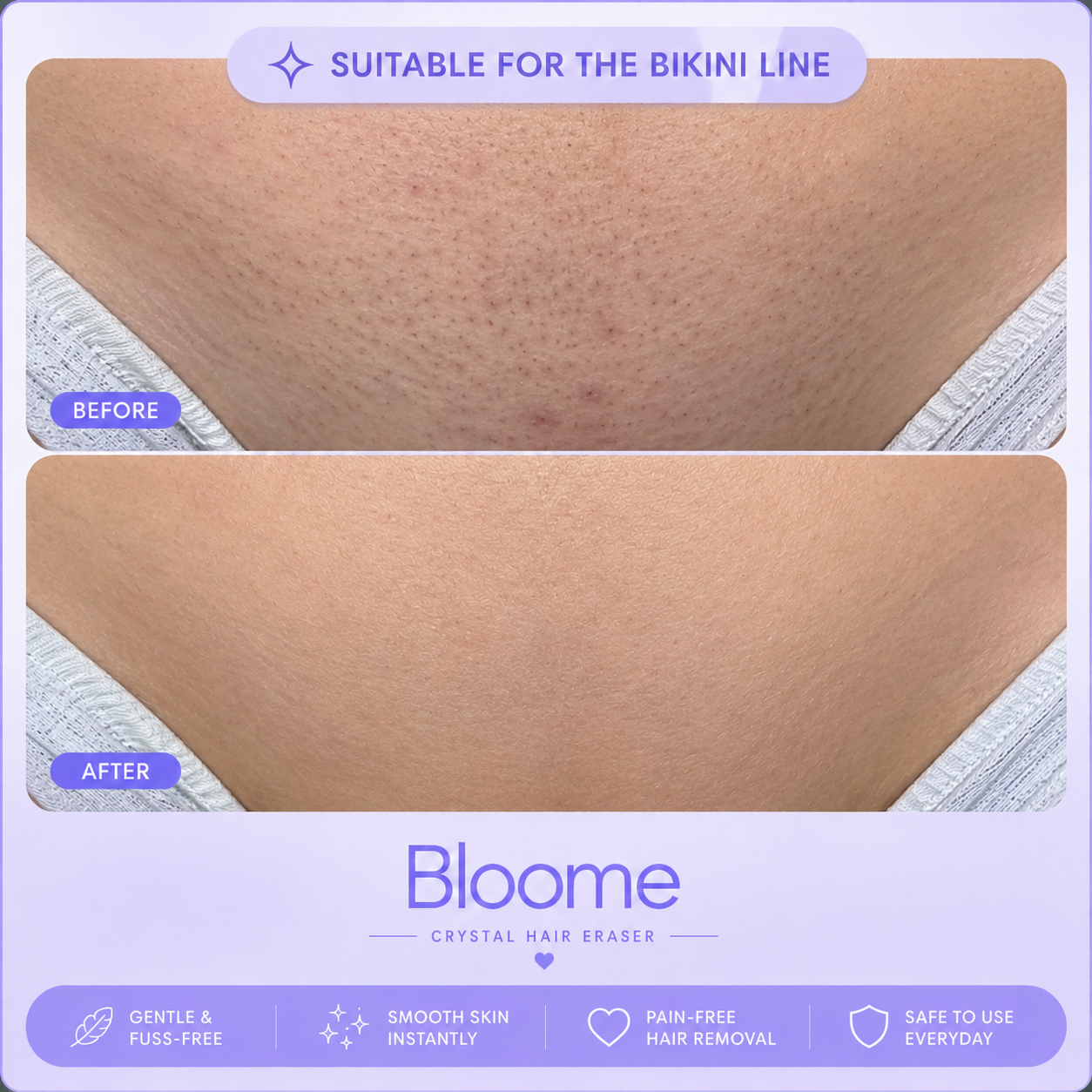 Bloome Crystal Hair Eraser